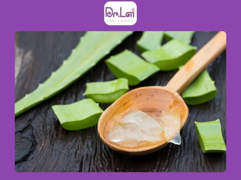 Dùng nha đam hỗ trợ làm dịu vùng da có mụn